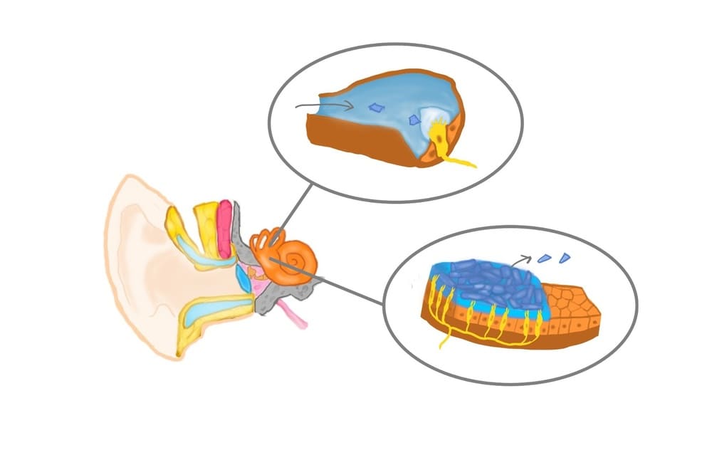 良性発作性頭位めまい症